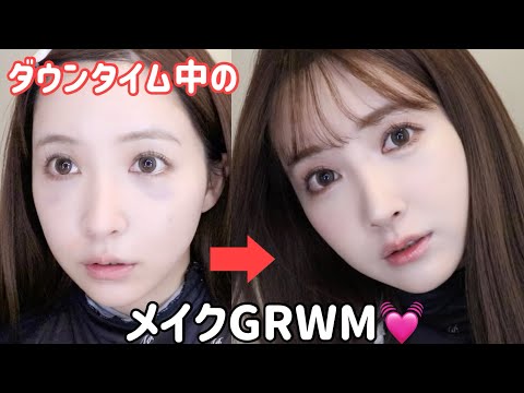ダウンタイム中にメイクしたら意外と盛れた。