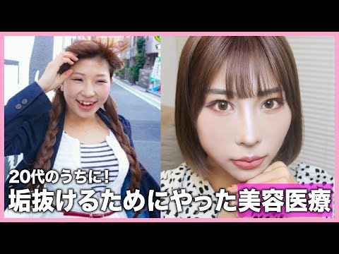 ハイフ？アートメイク？実際どうなの…個人的にやって良かった＆後悔した美容全て教えます！