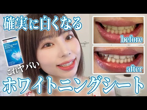 実際どうなの？ハワイで購入した【ホワイトニング】シート検証レビューしてみた！